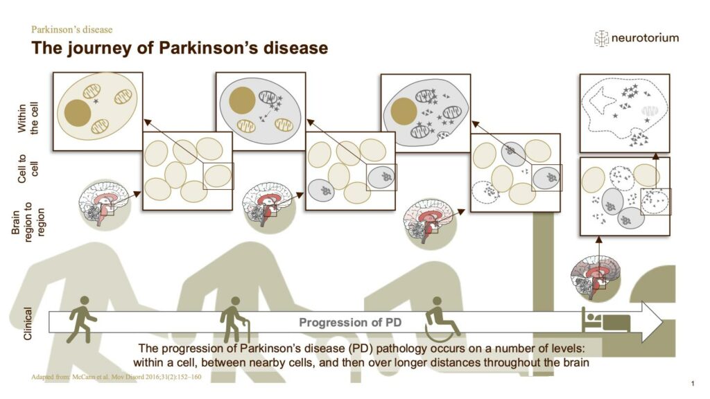 The journey of Parkinson’s disease